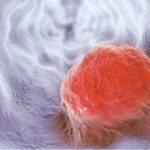 AI_Breakthrough_Doubles_Early_Esophageal_Cancer_Detection___