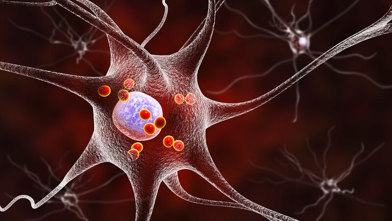 Breakthrough_in_Parkinson_s_Treatment__Chinese_Scientists_Discover_Key_Target___ - 🌍NewspaperAmigo – Your Global News Buddy 🗞️ Breakthrough_in_Parkinson_s_Treatment__Chinese_Scientists_Discover_Key_Target___