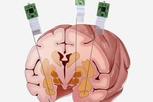 China’s Neuroscroll Breakthrough: Monkey Brains & Tech Gains 🧠🚀 China_s_Neuroscroll_Breakthrough__Monkey_Brains___Tech_Gains___