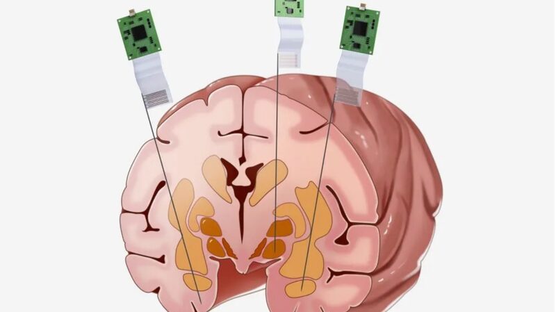 China_s_Neuroscroll_Breakthrough__Monkey_Brains___Tech_Gains___
