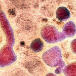 H5N1_Mutation_Could_Heighten_Human_Risk__Study_Warns___