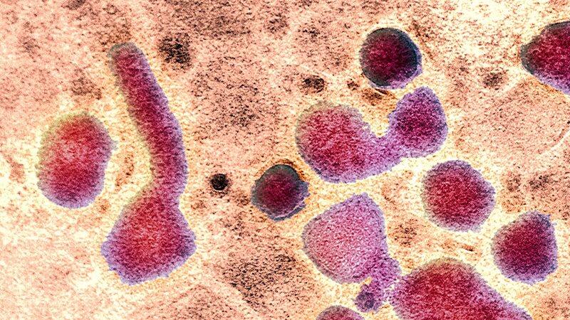 H5N1_Mutation_Could_Heighten_Human_Risk__Study_Warns___ - 🌍NewspaperAmigo – Your Global News Buddy 🗞️ H5N1_Mutation_Could_Heighten_Human_Risk__Study_Warns___