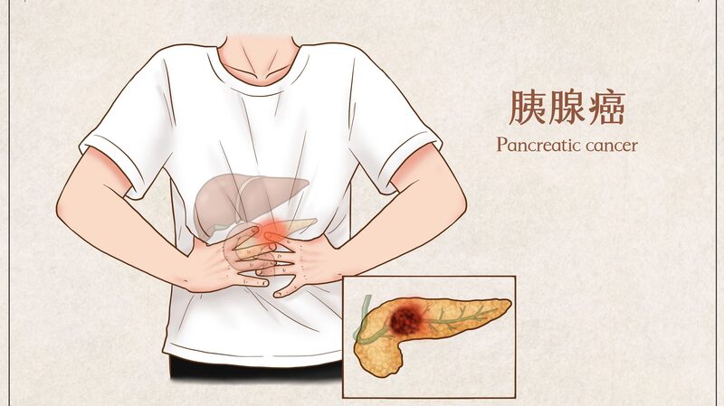 Israeli_Breakthrough_Eases_Pancreatic_Cancer_Pain_Without_Surgery___ - 🌍NewspaperAmigo – Your Global News Buddy 🗞️ Israeli_Breakthrough_Eases_Pancreatic_Cancer_Pain_Without_Surgery___