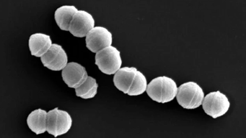 Japan_Sees_Surge_in__Flesh_Eating_Bacteria__Cases__What_You_Need_to_Know__ - 🌍NewspaperAmigo – Your Global News Buddy 🗞️ Japan_Sees_Surge_in__Flesh_Eating_Bacteria__Cases__What_You_Need_to_Know__