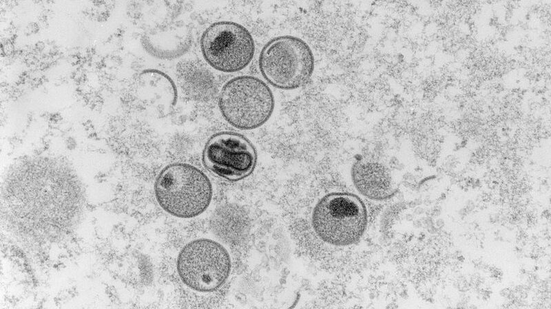Jordan_Reports_First_Mpox_Case_of_2024____