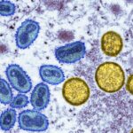 Mpox_Outbreak_Declared_Continental_Emergency_in_DRC____