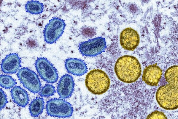Mpox Outbreak Declared Continental Emergency in DRC 🌍⚠️ Mpox_Outbreak_Declared_Continental_Emergency_in_DRC____