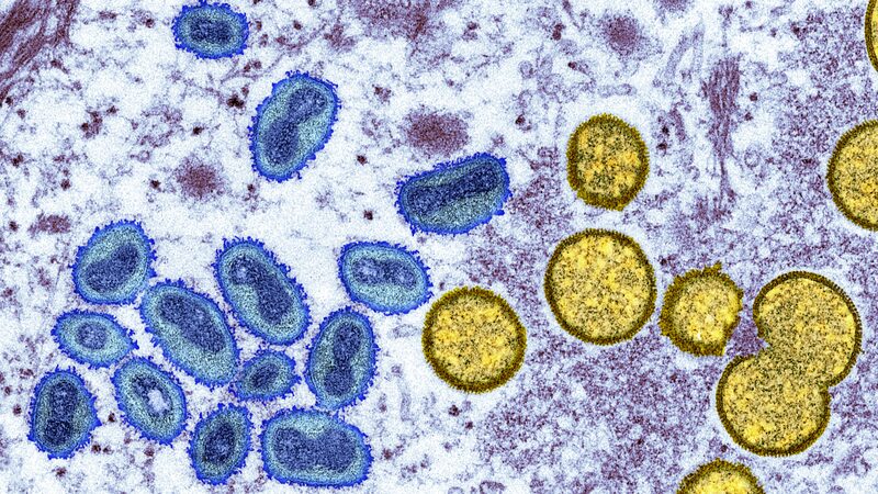Mpox_Outbreak_Declared_Continental_Emergency_in_DRC____