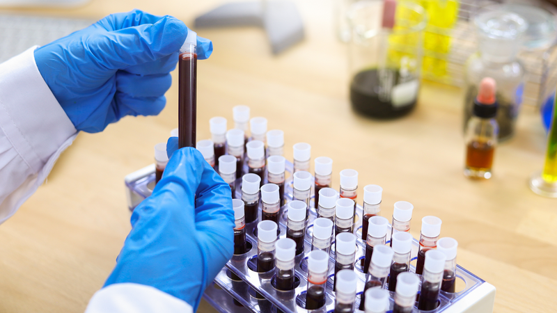 China Approves First Gene Therapy for Hemophilia B 🧬 China Approves First Gene Therapy for Hemophilia B 🧬