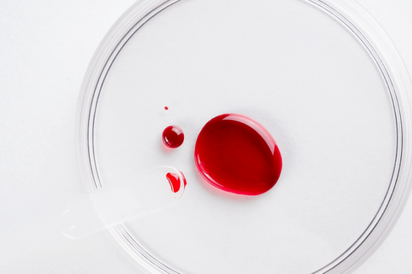 Alarming Study: 85% of Aussies Have ‘Forever Chemicals’ in Blood ๐ฉธ๐ฆ๐บ Alarming Study: 85% of Aussies Have 'Forever Chemicals' in Blood ๐ฉธ๐ฆ๐บ
