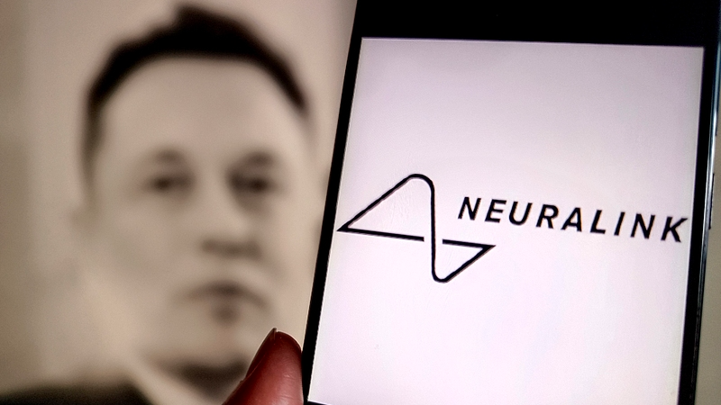 Neuralink’s Brain Chips: 7 Patients, Infinite Possibilities 🧠💡