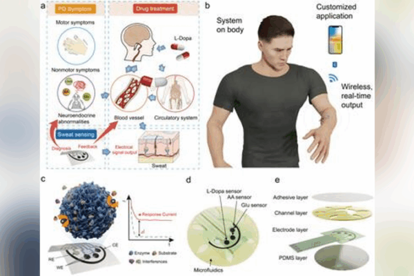 Chinese Scientists Develop Wearable Tech to Track Parkinson’s Early 🩹💡 Chinese Scientists Develop Wearable Tech to Track Parkinson’s Early 🩹💡