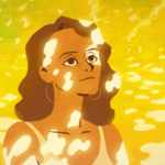 From Spots to Strength: Artist Turns Vitiligo into Animated Inspiration 🌟🎨