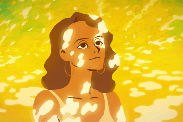 From Spots to Strength: Artist Turns Vitiligo into Animated Inspiration 🌟🎨 From Spots to Strength: Artist Turns Vitiligo into Animated Inspiration 🌟🎨
