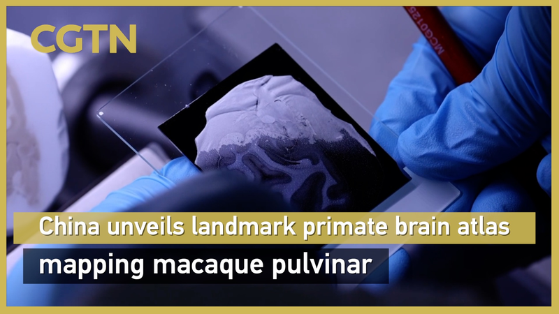 China’s Macaque Brain Atlas Breaks New Ground 🧠🌍 China's Macaque Brain Atlas Breaks New Ground 🧠🌍 video poster