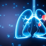 🌬️ Air Pollution Tied to Lung Cancer Mutations in Non-Smokers, Study Finds