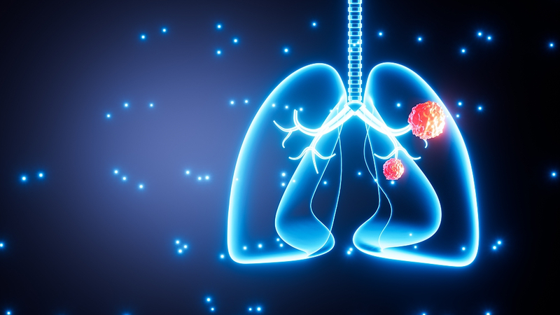 P8MD5L0GCFB7PYMJRCG6 - 🌍NewspaperAmigo – Your Global News Buddy 🗞️ 🌬️ Air Pollution Tied to Lung Cancer Mutations in Non-Smokers, Study Finds