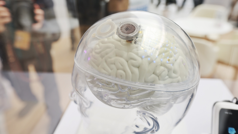 China’s MedTech Breakthroughs: From Sci-Fi to Real Life 🧠💡