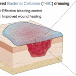 Chinese Scientists Revolutionize Burn Care with Bioactive Dressing 🌟🩹