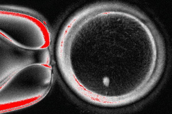 Scientists Turn Skin Cells into Human Eggs in Groundbreaking Study 🧬✨ Scientists Turn Skin Cells into Human Eggs in Groundbreaking Study 🧬✨