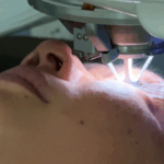 HDKMMHOWDB08FQUQQGPV - 🌍NewspaperAmigo – Your Global News Buddy 🗞️ AI Revolutionizes LASIK Surgery: Faster, Safer, Smarter 👁️💻 video poster