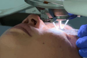 AI Revolutionizes LASIK Surgery: Faster, Safer, Smarter 👁️💻 video poster