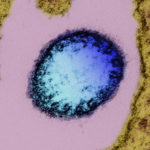 I100902PIZDME3II067X - 🌍NewspaperAmigo – Your Global News Buddy 🗞️ China Boosts Nipah Virus Defenses Amid Global Concerns 🦠🛡️