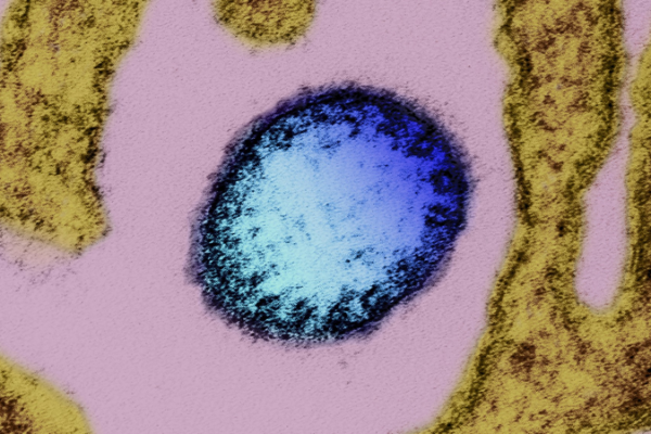 China Boosts Nipah Virus Defenses Amid Global Concerns 🦠🛡️