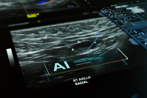 AI Boosts Breast Cancer Detection in Groundbreaking Trial 🩺🤖