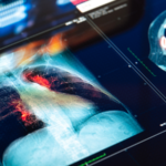 Artificial Lung Breakthrough Saves Patient in 48-Hour Race Against Time 🏥💨