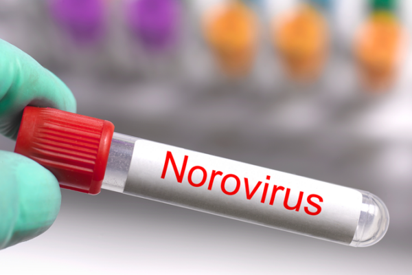 Japan Faces Fifth Week of Norovirus Surge 🚨