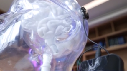 China Greenlights World’s First Invasive BCI for Medical Use 🧠✨