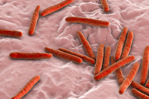 SA Team Launches Handheld TB Detector: Faster, Safer Diagnosis 🌍🩸