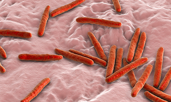 SA Team Launches Handheld TB Detector: Faster, Safer Diagnosis 🌍🩸