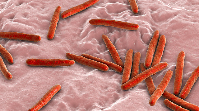 SA Team Launches Handheld TB Detector: Faster, Safer Diagnosis 🌍🩸